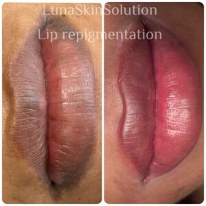 PMU – Dark Lip Neutralization PMU - Dark Lip Neutralization