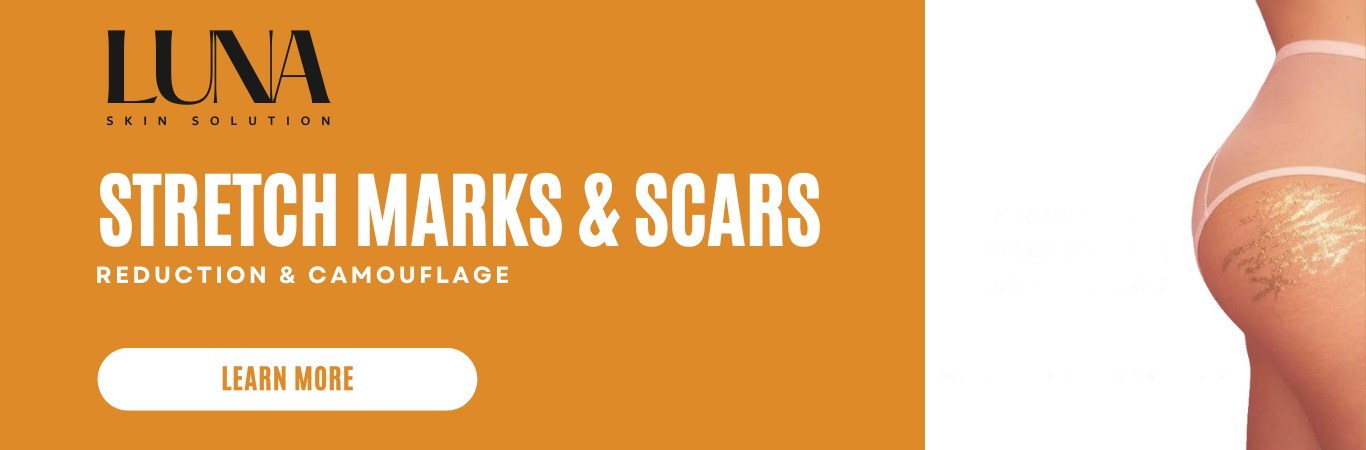 Scars and Stretch marks banner